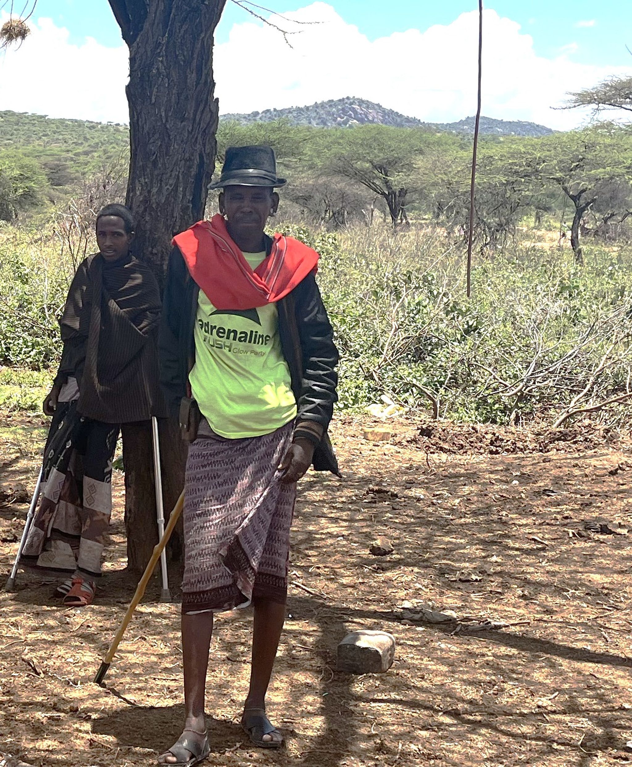 Een jongen met een gebroken been omdat hij in aanraking kwam met een olifant in Kenia.